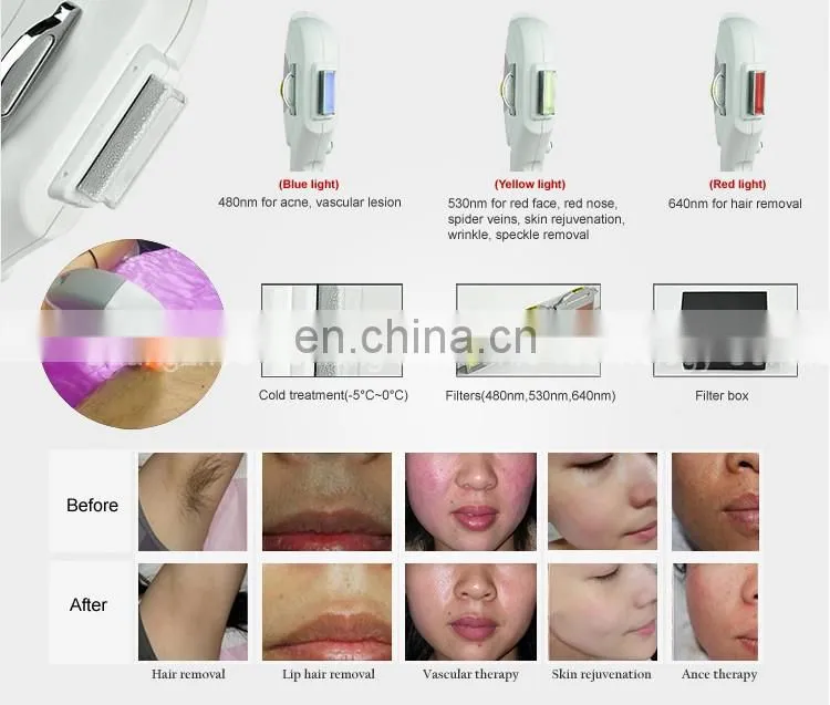 3 in 1 laser hair removal machine/ipl hair removal laser tattoo removal
