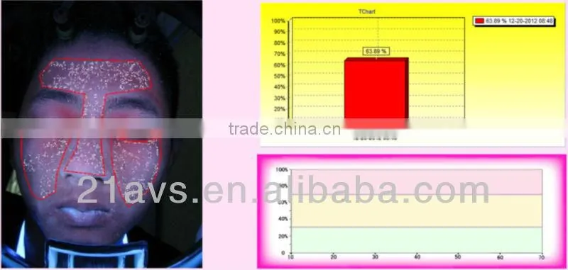 Guangzhou facial skin analysis machine