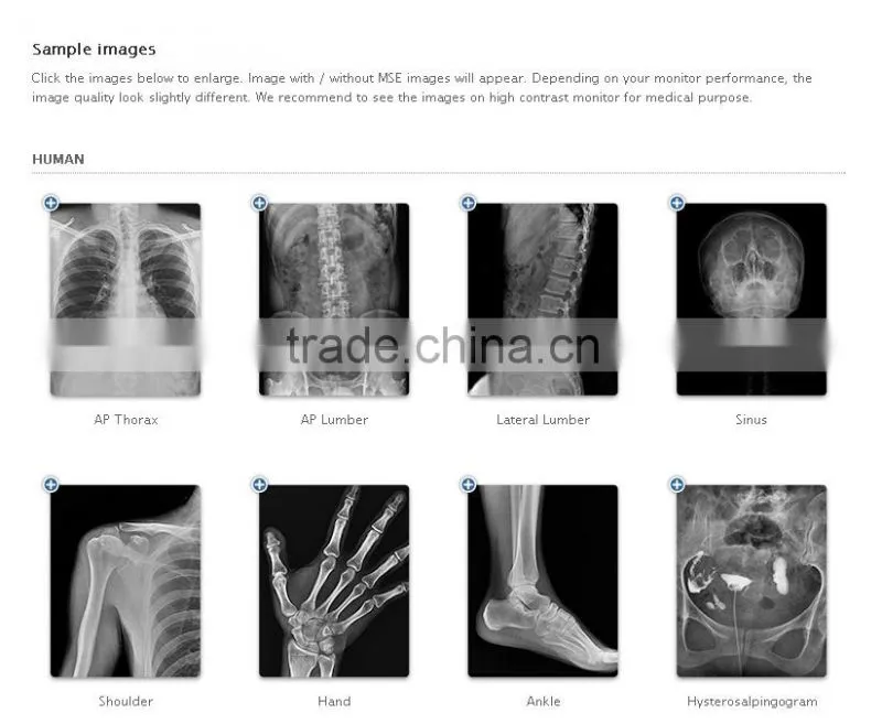 Direct Digital Radiography System
