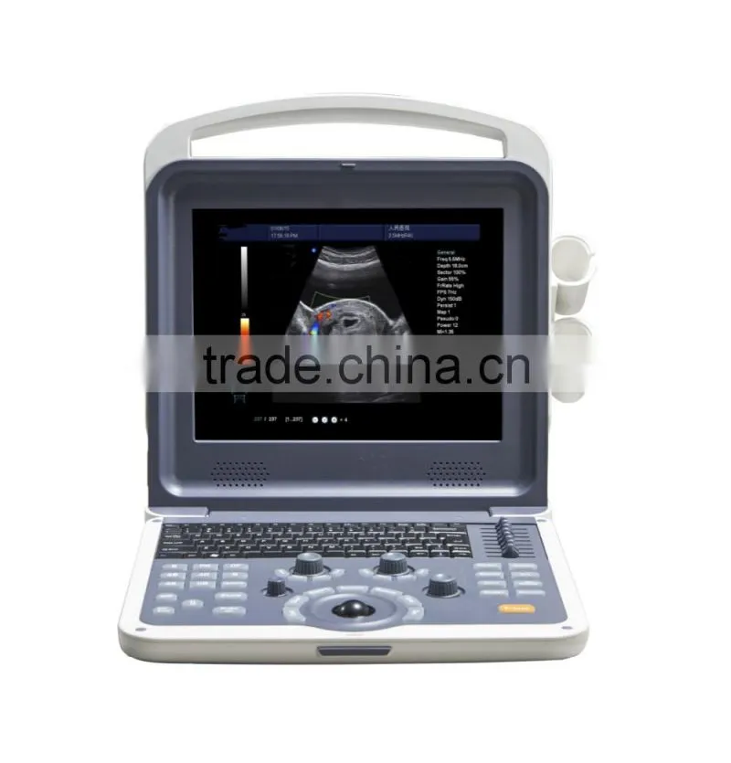 Color Doppler Ultrasound