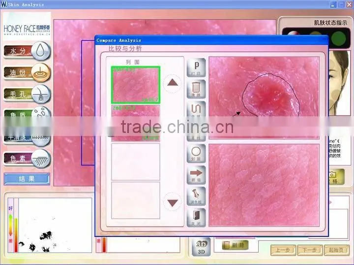 2013 Beauty salon/home use touch screen beauty care equipment skin diagnosis purpose BD-P006