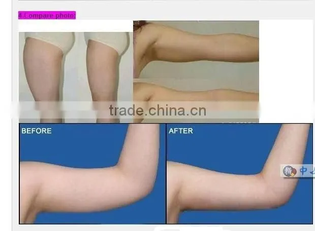 2012 the most multifunctional beauty and slim Equipments