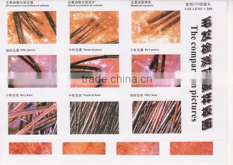Professional skin and hair analyzer with new style