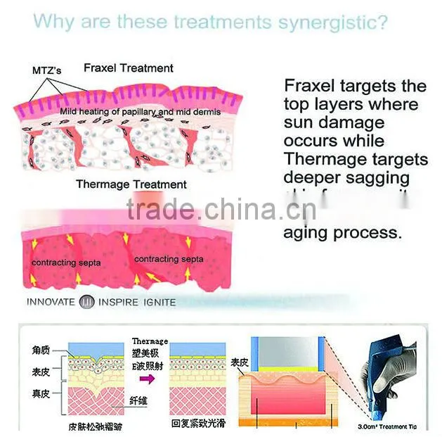 F998 Portable micro-needle fractional rf face lift machine
