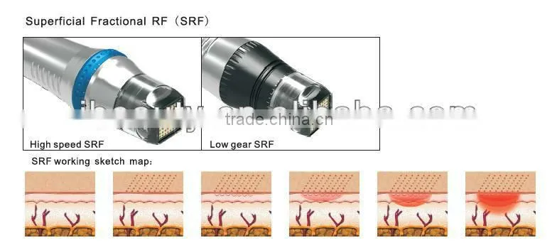 Effective RF Shaper Skin Tightening Machine for Home Use fractional RF