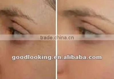 Top sell!!! oxygen jet beauty machine/oxygen facial equipment