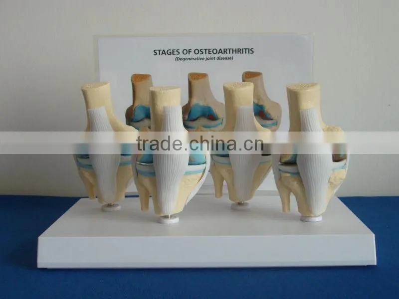 V-AM036 Plastic Human Knee Anatomic Model