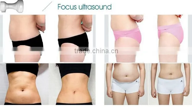 Ultrashape machine anti cellulite vacuum slim belly weight loss equipment