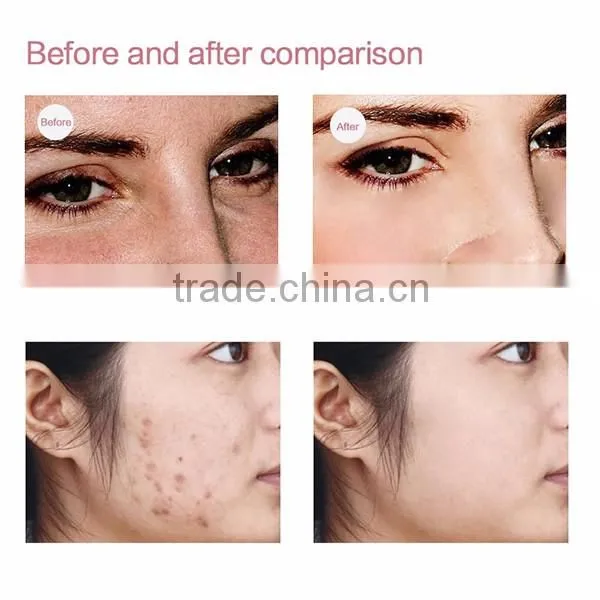 EYCO facial light therapy devices acne blue light therapy red light therapy for face mask