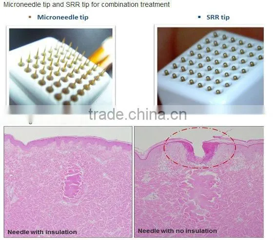 Top performance!!!! microneedle skin treatment portable fractional rf