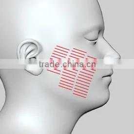 CE Certificated HIFU portable machine/korea/body/face lift Belle-HIFUhifu high intensity focused ultrasound
