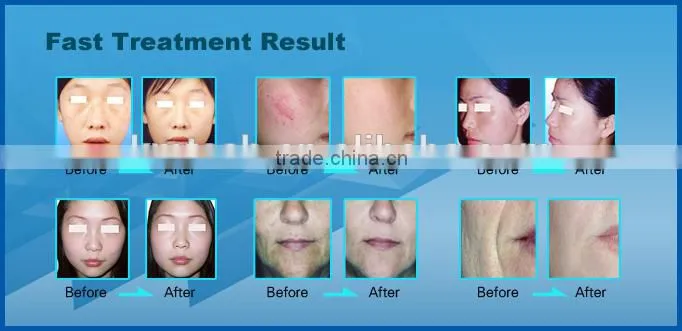 Multifunctional beauty machine made in china