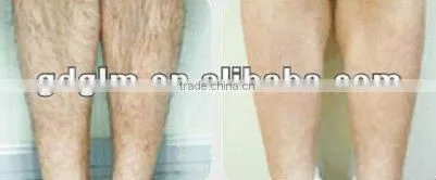ipl machine photo skin rejuvenation