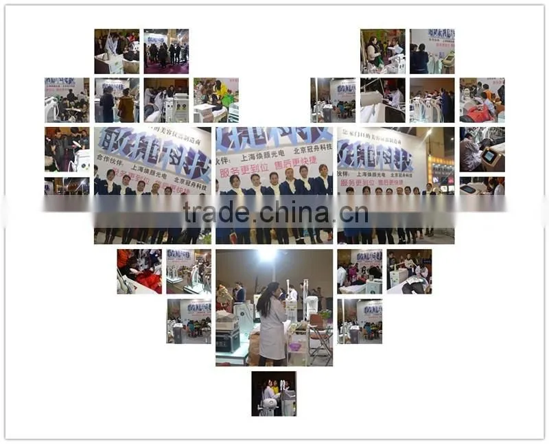 New design ipl shr opt laser permanent home medical device