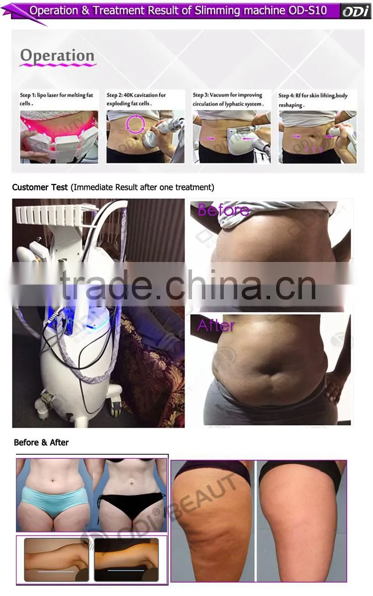 Quick slim! OD-S10 4 in 1 multifunction non invasive lipo cavitation machine