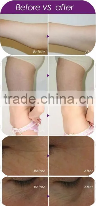 Russia Sell like hot cakes!!!7 in 1 Cavitation/Slimming Cavitation Machine/Cavitation RF Equipment for Home Use