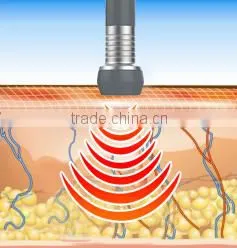 Hot!Suslaser Fast Radio Frequency System Cavitation Cellulite Slimming System For Home Use