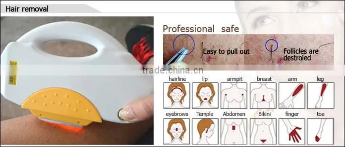 2016 portable 6 in 1 ultrasound beauty equipment for rf fractional cavitation