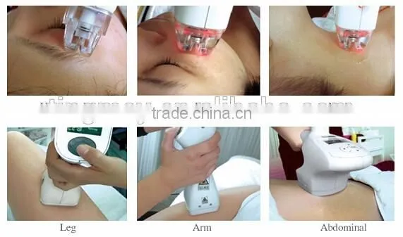 Vacuum RF Cavitation Infrared Laser Vacuum Roller Massage