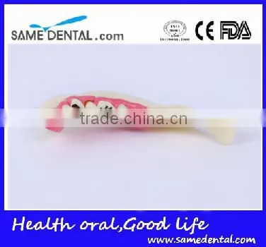 Hemi mandible anatomical model Dental Eduction Assitant No. DEA-18