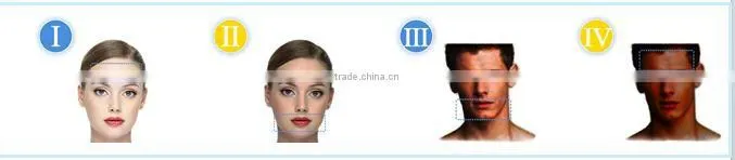 2016 professional 808nm diode laser hair removal machine/ 808 diode laser