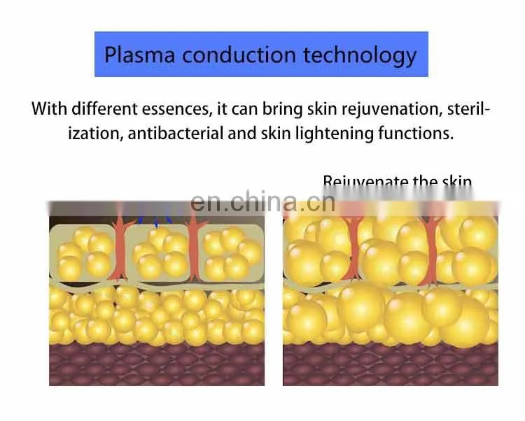Home Use Cold Plasma Ozone Shower Pen for Acne Removal