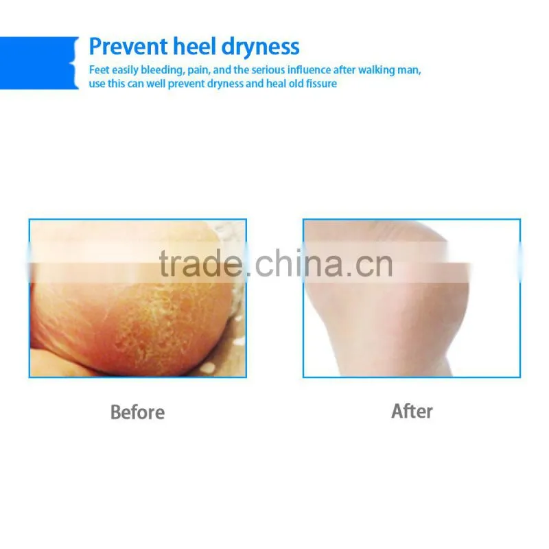 Professional foot care silicone gel heel pad protector
