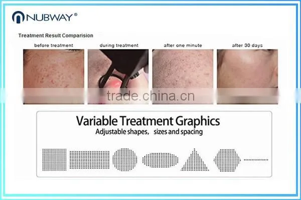 Factory direct sale!!!! 40W best quality skin renewal beauty rf fractional co2 laser