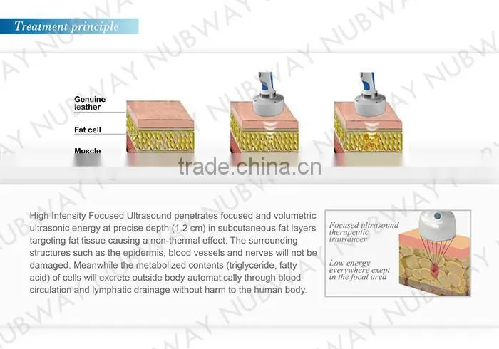 HIFUSHAPE nubway hifu for body slimming fat loss hifu equipment