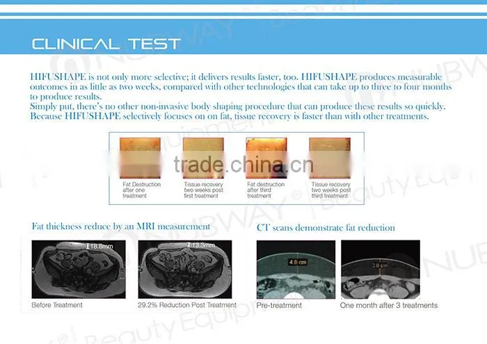 PROMOTION!New beauty for 2015 High Quality Ultrasonic wave slim HIFU Slimming machine