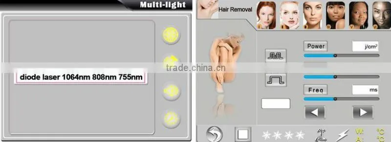 2016 laser hair removal machine alexandrite laser with 755/808/1064nm wavelength