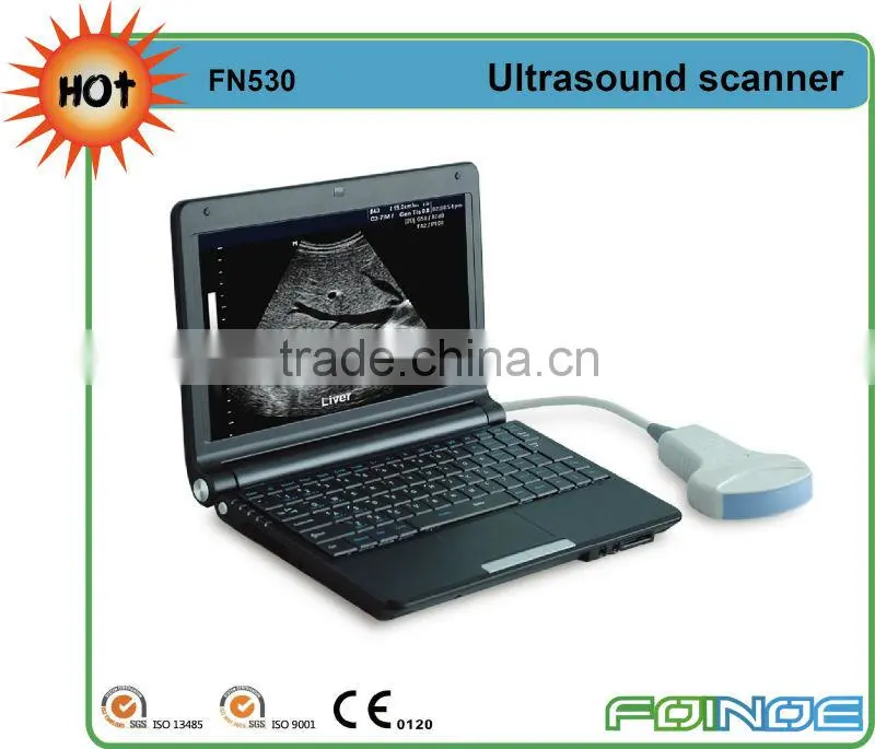 FN218 Full digital B model ultrasound probe usb