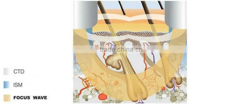 AYJ-T05 (CEbest portable bipolar rf and tripolar rf skin tightening face lifting machine / rf machine