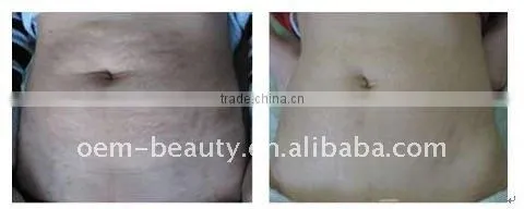 Micro needle LED Theory MT Titanium Derma Roller L004