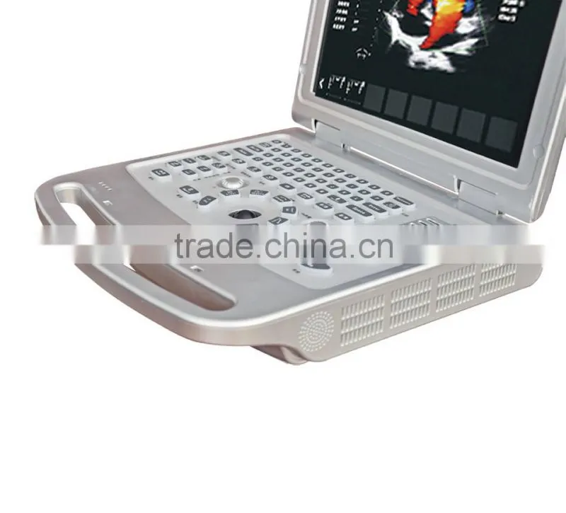 15 inch laptop Color Doppler 64G image-storage capacity ultrasound scanner for hospital