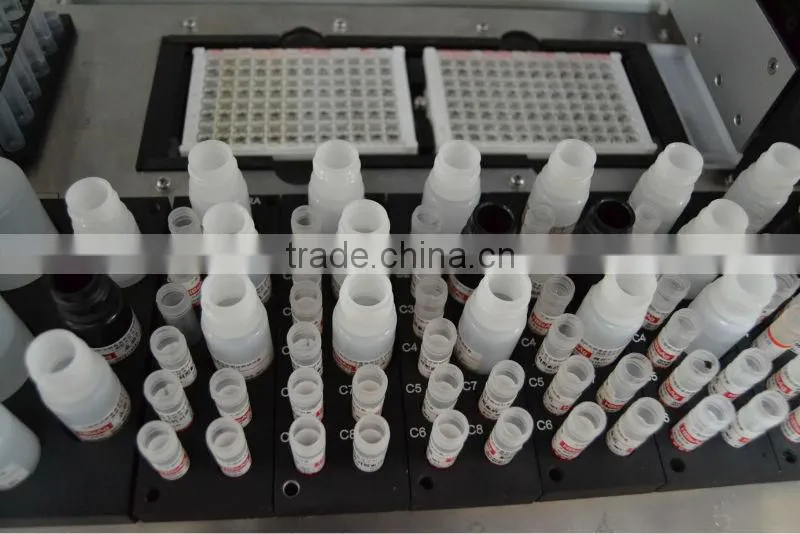 Fully automatic elisa analyzer, IVD analyzer- with four microplte (skype: fangfeimengxiang876)
