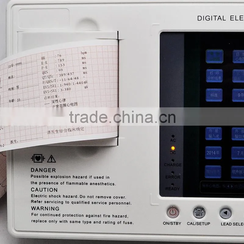 Digital Three Channel 12 lead ECG Machine--CE FDA Approved color Echocardiogram