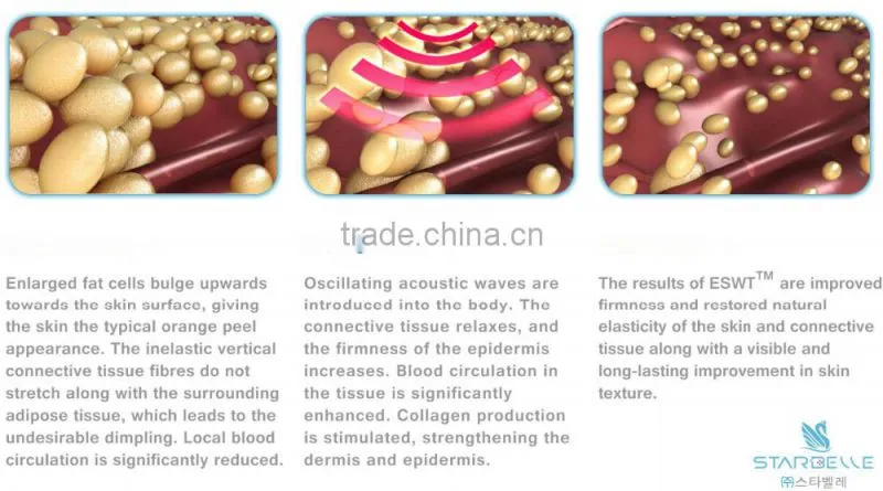 ESWT Shock Wave Therapy For Cellulite Treatment Devices - ESWT SD