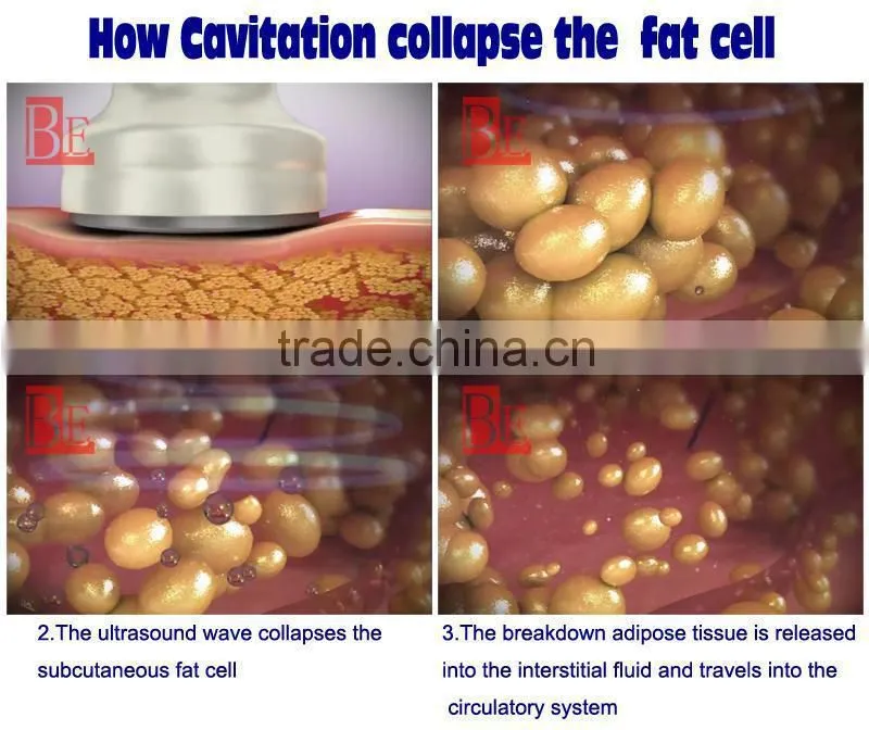 face lift/ultrasonic cavitation radio frequency machine/ultrasound face lift