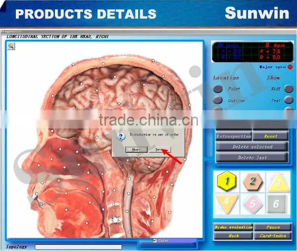 3D NLS Health Diagnostic Analyzer with wholesale price with high quality