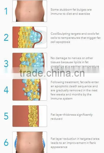 Promotion!!! CE approved newest cryo lipolysis body slimming devices