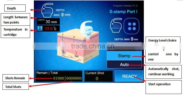 2016 new lipo slimming machine Physical & Effciency u shape hifu weight lose machine