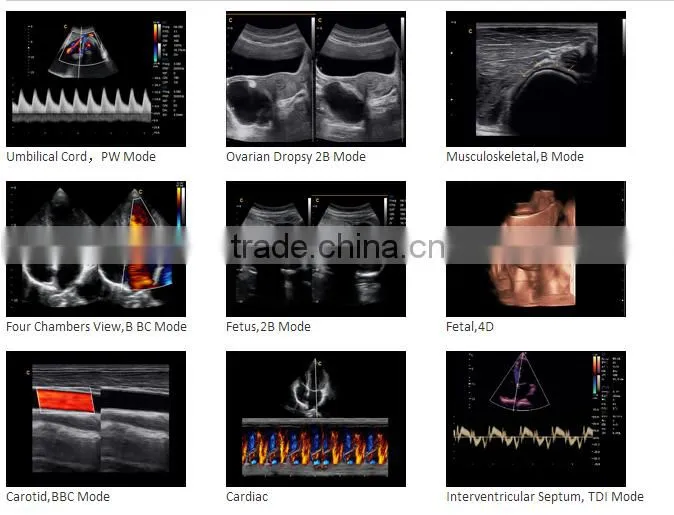 CE ISO approved medical 15 inch LCD Monitor 3D 4D trolley color doppler ultrasound scanner