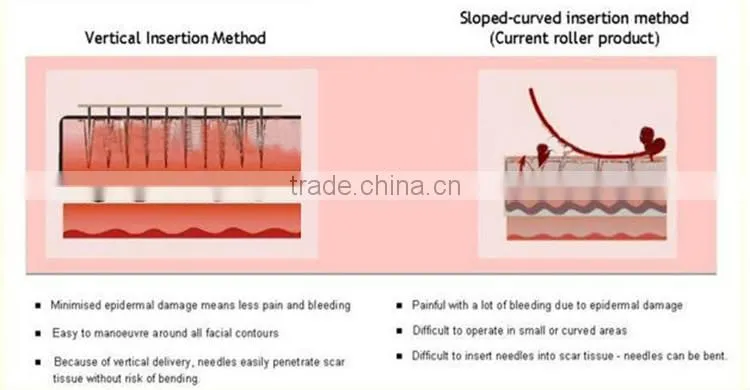 Wholesale Auto microneedle therapy system Electric dermapen