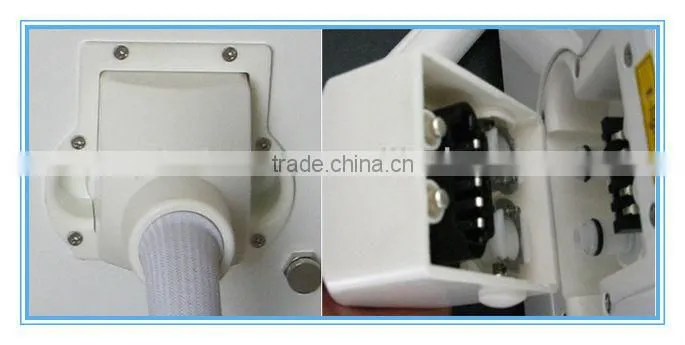 The Best Portable IPL Machine Master IPL