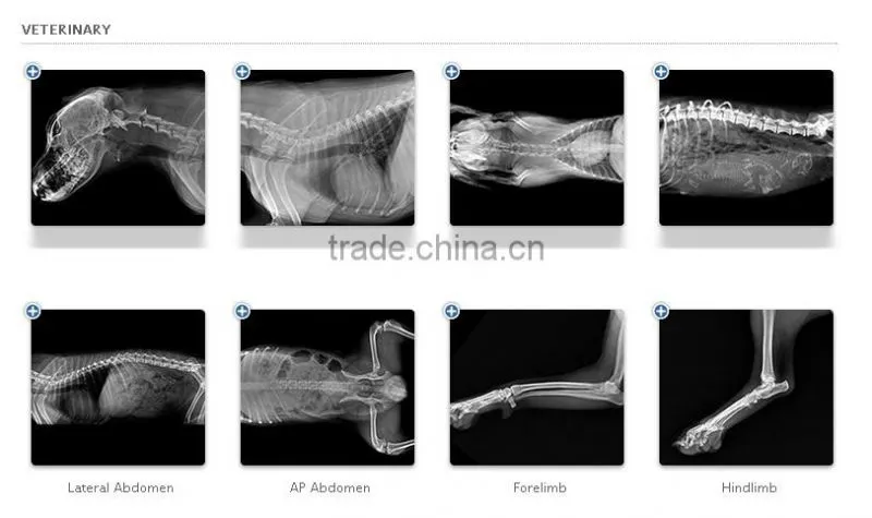Direct Digital Radiography System