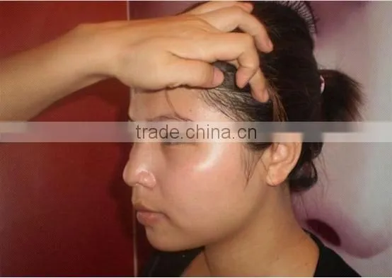 IPL RF Laser beauty equipment