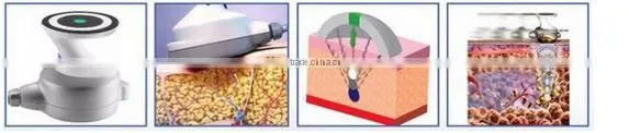 3D positioning weight loss lipo hifu equipment