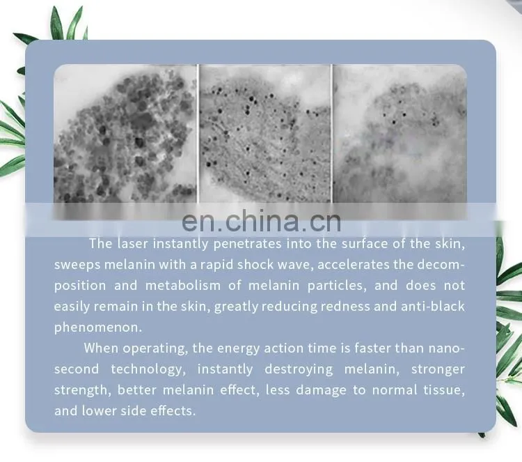 Hottest New Design Pico Tattoo Removal Laser Machine CE Approval
