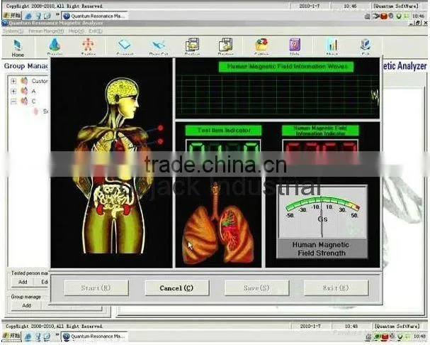 Mini Quantum Magnetic Resonance Analyzer BD-R008